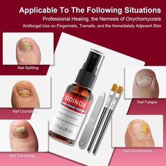 Toenail Fungus Treatment, Treatment Extra Strength with 25% Undecylenic Acid;