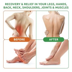 Neuropathy Pain Relief Cream – Maximum Strength Nerve Pain Reliever for Foot,…