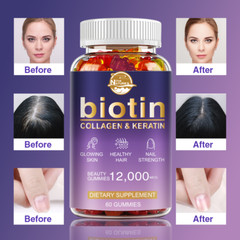 Collagen Vitamin Gummies for Hair Skin & Nails, #1 Premium Collagen Supplement