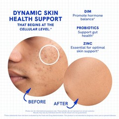 Clear Skin Supplement with Zinc, DIM and Probiotics | 3-in-1 Balance, Glow an