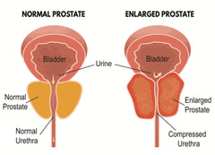 Holistic Mushroom Therapy – PROSTATE SUPPORT – Full-Body Saw Palmetto 1B