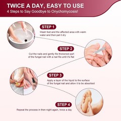 Toenail Fungus Treatment, Treatment Extra Strength with 25% Undecylenic Acid;