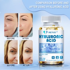 Hyaluronic Acid Capsules 850MG – For Healthy Skin & Joint Support 120 Capsules