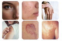 casia alata leaves powder for Skin rash Mould and fungus smooth skin 80g/50g/30g