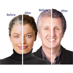 Stinging nettle root – ANTI GRAY HAIR FORMULA – health complex – 3 Bottles