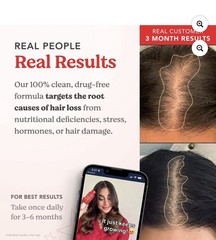 HAIRtamin Advanced Formula Supplement for Hair Health, with Biotin Vegan 30 caps