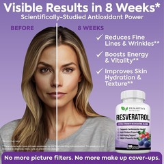 Extra Strength Resveratrol 1568mg Capsules Antioxidant Supplements 180 Count 3