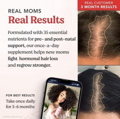 HAIRtamin MOM—30 Vegan Prenatal/Postnatal Multivitamin—1pk—See Below—24 HR SHIP—