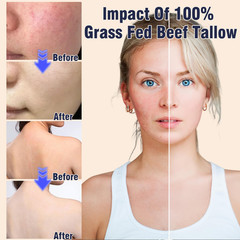 Beef Tallow Face Moisturiser – 100% Grass Fed Beef Tallow for Skin Care – Natura