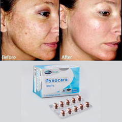 3x Pynocare Whiten Skin Reduce Melasma Dark Spots Clear Skin UV Protection.