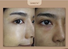 Gluta All in one Anti Aging Reduce Acne Detox Toxin Healthy Skin 2 Month Supply