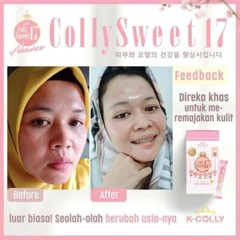 K-COLLY SWEET17 Korean Nano Collagen Advance Triple Whitening 60’s FREE BOOSTER