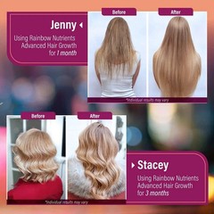 NEW Rainbow Nutrients ADVANCED Hair Growth Vitamins – Biotin 10,000mcg, Collagen