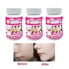 White Gluta Supreme 1500000 Mg V Shape Face Whitening Anti Aging 3×30 Softgels