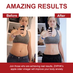Apple Cider Vinegar 3000mg Weight Loss Fat Burning Weight Loss Caps High Potency